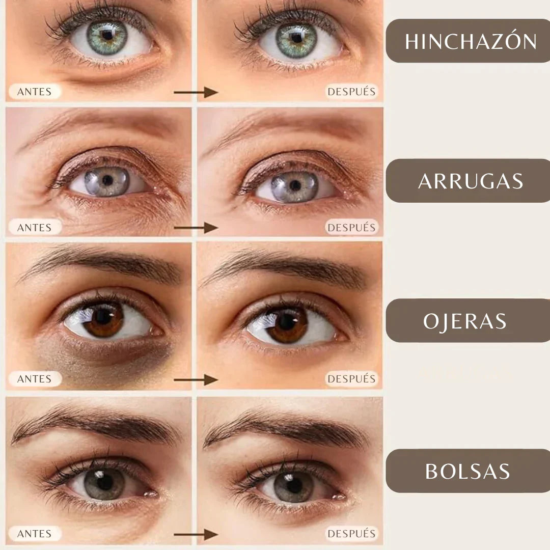 Parches Para los ojos - Aloe Vera , Acido Hialuronico 60 Laminas🍀