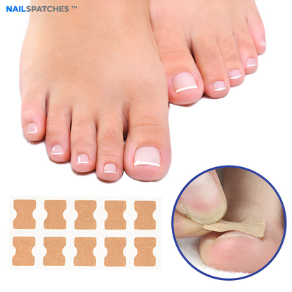 Parche para Hongos NailSpatches™ |  1 Caja + 1 caja Gratis(32 Parches)