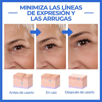 Suero Facial Anti edad 2X1 Oferta Limitada