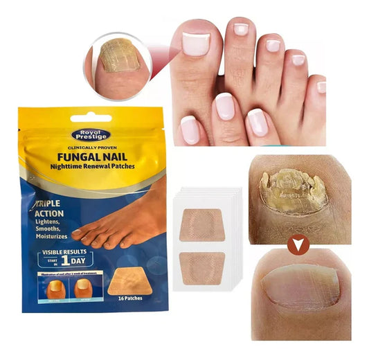 Parche para Hongos NailSpatches™ |  1 Caja + 1 caja Gratis(32 Parches)